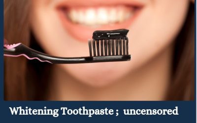 Whitening Toothpastes; Facts and Fallacies