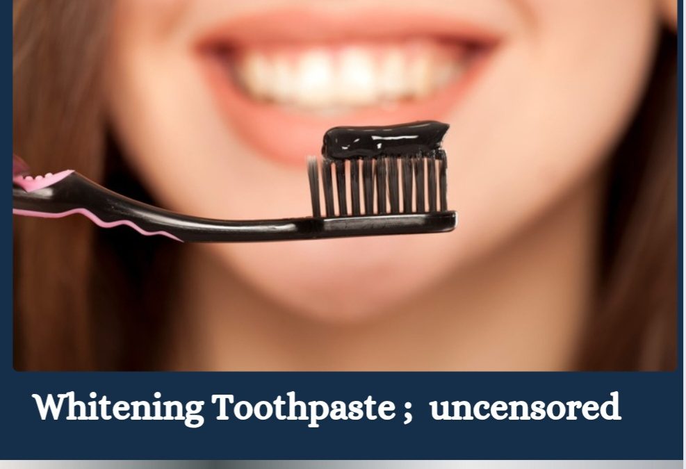 Whitening Toothpastes; Facts and Fallacies